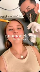 👃✨ ¡Acompáñenme en mi experiencia de Rinomodelación con el mejor doctor de  Puebla! 💉🔝, Siempre soñé con un perfil más armonioso sin cirugía, y con  el Dr. Filo Huesca lo hice posible con ácido ...