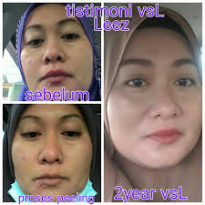 Argan oil face treatment 6. Vsl Beauty Care Apa Yg Vsl Beauty Care Leezniel Facebook