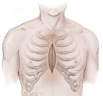Rigid Plate Fixation for Sternal Closure - Operative ...