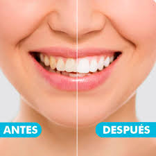 POLVO BLANQUEADOR DE DIENTES Veze Clin® 💎 – La Iguana Shop