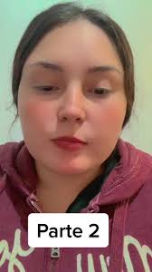 Parte 2 del Caso de Microcefalia de Valentina