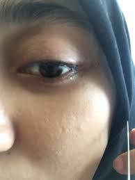 Mayat kemungkinan dibawa arus ketika hujan lebat, katanya dalam satu kenyataan. Kesan Gigitan Kutu Babi Mimin Adam