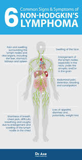 Cancer symptoms are changes in the body caused by the presence of cancer. Pin On James