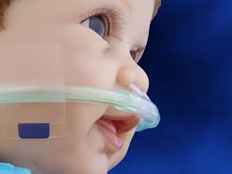 Infant nasal cannulas are typically classified as being for micro premature, premature, neonate, infant and intermediate infant size patients. Ram Cannula For Low High Flow Oxygen Neotech Products