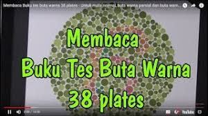 Download tes buta warna pdf. Cara Membaca Buku Tes Buta Warna Isihara 38 Plates How To Read Isihara 38 Color Blind Test Book Youtube