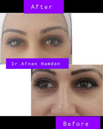 Dr. Afnan Hamdan د. أفنان حمدان