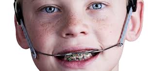 Dr. Biermann Orthodontics Blog