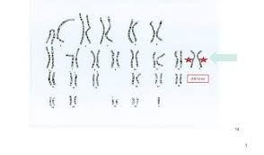 Bilde av fartøy top advancer (mmsi: Infothek Genetikum Klinefelter Syndrom Ein X Zu Viel Macht Den Unterschied