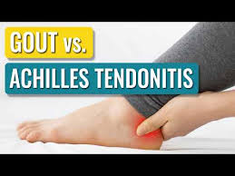 Image result for gout