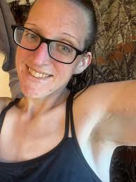 Shaving armpits after VSG weight loss surgery