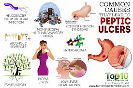 This Article Is About Peptic Ulcer Its Symptoms Causes Diagnosis And Treatment 12 Home Remedies Are Given That Peptic Ulcer Stomach Ulcers Symptoms Ulcers