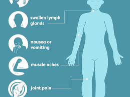 West nile virus in the u.s. West Nile Virus Signs Symptoms And Complications