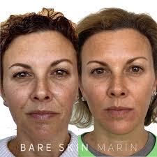 Bare Skin Marin (@bareskinmarin) · Kentfield, CA