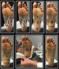 Foot Taping For Plantar Fasciitis Plantar Fasciitis Taping Plantar Fasciitis Treatment Plantar Fasciitis Exercises