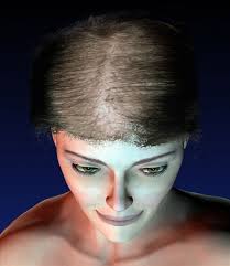 Cela vous aidera à mieux connaître la nature de ses cheveux et les. Dermato Info L Alopecie