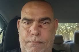 Fundraiser by Steven Nero : Help a Veteran in need of surgery for Cancer