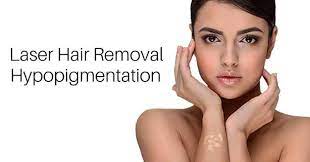 If you're not able to shave, our laser technicians will be able to do it for an extra cost of only. Laser Hair Removal