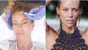 Son libres y no tengo nada con ella pero me pareció innecesario que manuel haya querido verse conmigo y me ponga en esta situación. Nicole Mostro El Antes Y Despues De Aplicarse Botox En El Rostro