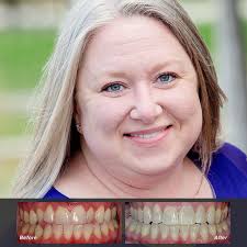 JEREMIAH & MELODY Before and After Photos Reno NV