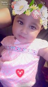 Alannah's Fibular Hemimelia