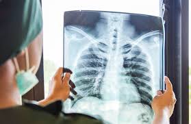 It was first identified in december 2019 in wuhan,. No Increased Risk Of Severe Covid 19 In People Living With Hiv But Vigilance Over Bacterial Pneumonia Required Aidsmap