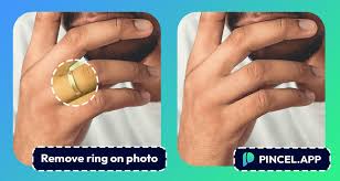 Image result for Ring Removal