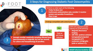Image result for Probe-to-Bone Test