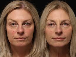 Re-introducing my rock star physician assistant