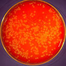 It is a facultative anaerobic bacterium, capable of surviving in the presence or absence of oxygen. Biotrading Ready Prepared Media Listeria Monocytogenes Blood Agar Lmba