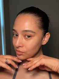 Skin journey · 16M threads