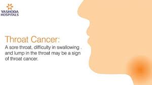 You get throat cancer when some cells in your throat get a change in their genes. Lump In Throat Cancer Lump In Throat When Swallowing And Sore Throat May Be A Sign Of Throat Cancer