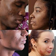 Dream Girl Collection