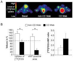 Fdg mimics glucose chemically and structurally. A 2 18f Fluoro 2 Deoxy D Glucose 18f Fdg Pet Scans Of Mice Download Scientific Diagram