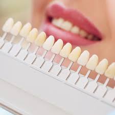 Brush your teeth after eating staining foods. Choosing Porcelain Veneer Color Nashville Tn Dr Clint Newman