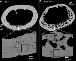 Related posts of cross section of human bone diagram human back muscles and bones. Backscattered Scanning Electron Microscopy Images Collected From The Download Scientific Diagram
