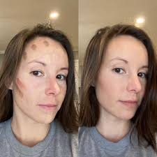 First time using my makeup since I've been sick for almost two weeks. I'd  say not bad for my first time ever contouring also 😂 Jonathan Lindsey  Glover color match was 👌🏻