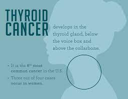 Thyroid cancers are often diagnosed by routine examination of the neck during a general physical exam. Thyroid Cancer Symptoms And Signs Dana Farber Cancer Institute