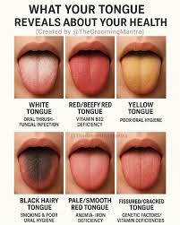 Image result for black tongue symptoms