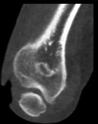 Image result for Traumatic Arthrotomy