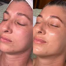 you deserve this. #skinbybta