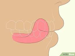 Biting down is initially required to produce a movement, however, many patients will undergo cerebral adaptation and in time develop an effortless smile. How To Fix An Uneven Smile And Look Your Best