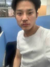 '버닝썬' 김상교, 소녀시대 효연에…그날 마약에 취한 배우 누구냐 단독현대차 디젤엔진 개발 중단, 내연기관 엔진개발 접는다 결혼 후 성욕 달라졌다…'불륜설' 美배우, 과거 성취향 고백 '충격' ê¹€ìƒêµ ë²„ë‹ì¬ ì‚¬ê±´ ìµœì´ˆ ì œë³´ìž ë‹¹ë‹¹í•˜ë‹¤
