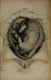 From A System Of Anatomical Plates By John Lizars 1822 Www Facebook Com Theirregularanatomist Www Twit Human Anatomy Art Anatomy Art Medical Drawings