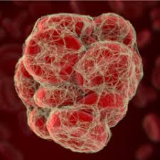 The causes described in the literature include the following: Embolia Cerebrale E Polmonare Cos E Cosa Puo Provocare Issalute