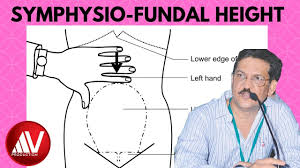 Importance of fundal height measurement. Symphysiofundal Height Measurement Explained Youtube