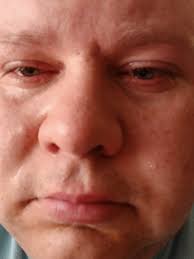 Armando #ALTIQ armando bull bar with behind the grill Altiq light bar