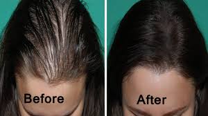 6 easy home hacks to make hair appear thinner. How To Thicken Thin Hair Naturally