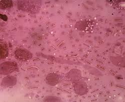 Image result for Rhizobium radiobacter, syn. Agrobacterium tumefaciens