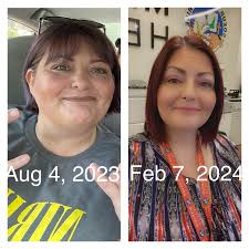 I had surgery a little over a year ago. I lost 100lbs within the first 7  months and I've been in a stall ever since. I have tried upping my protein  and