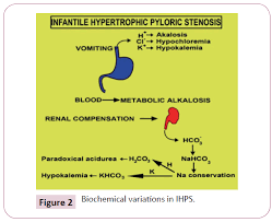 supererogate sophomore stricture infantile pyloric